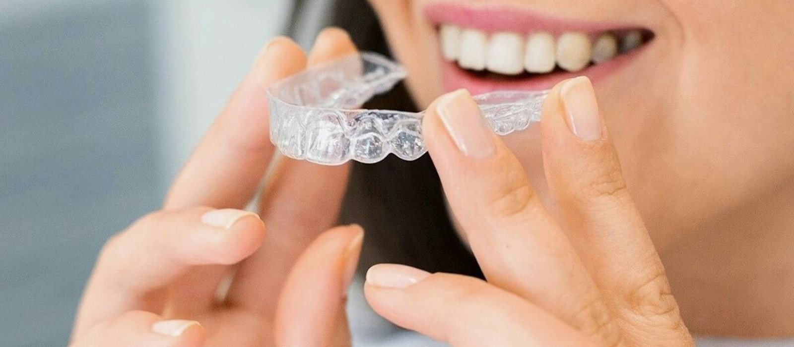 Invisalign Clear Aligners at Diamond Valley Dental