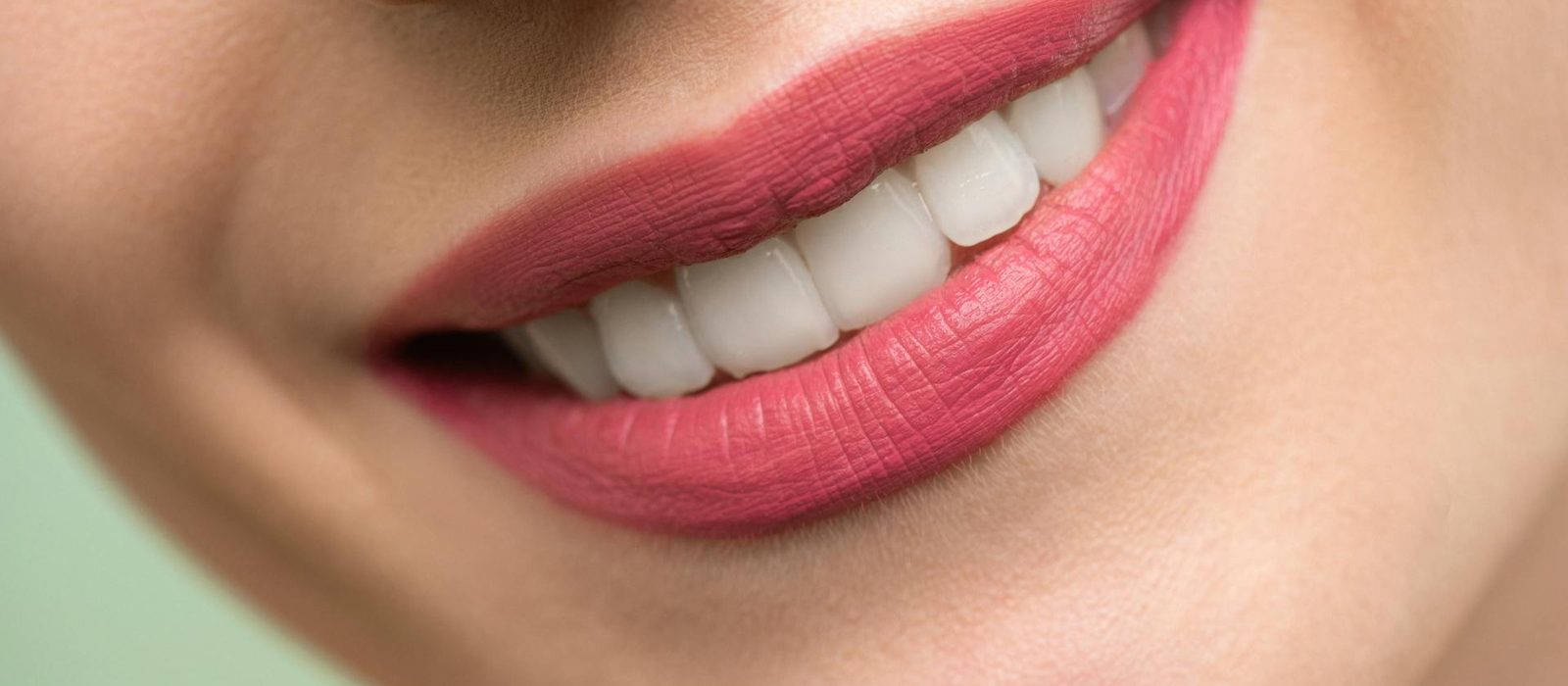 Porcelain Veneers at Diamond Valley Dental